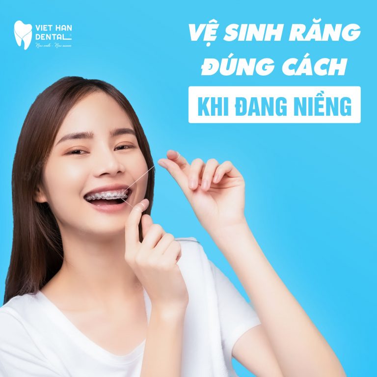 Phương pháp vệ sinh răng miệng đúng cách khi đang niềng răng