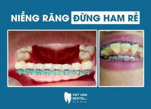 nieng-rang-gia-re