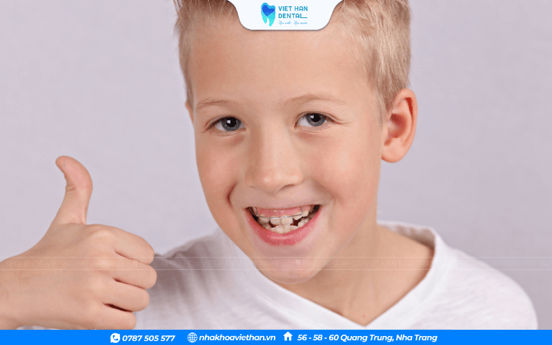 Niềng răng ở trẻ em